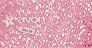 Obrázek k výrobku Práškové oční stíny Stardust varianta - Think Pink